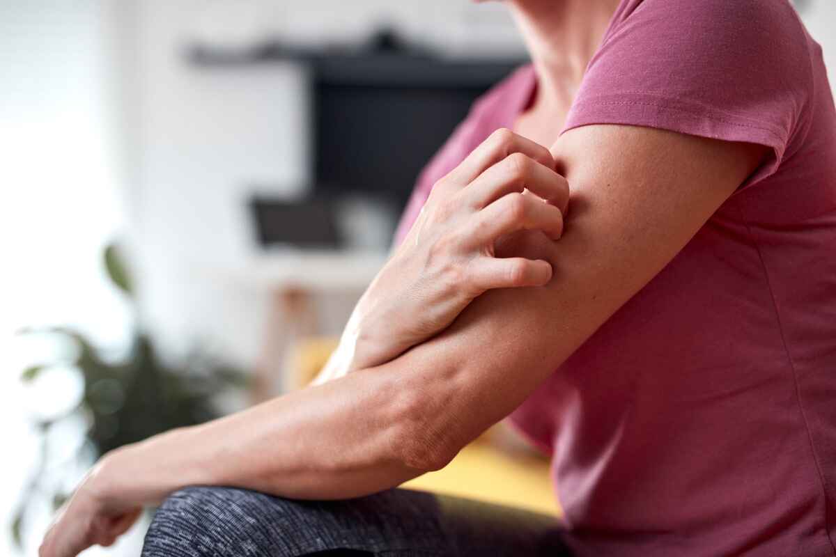 Woman scratches her arm
